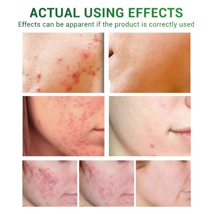 Essential Oils for Scar Repair and Skin Care Lumina Luxe Beauty