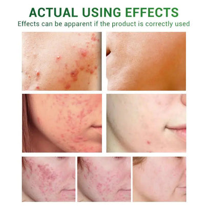 Essential Oils for Scar Repair and Skin Care Lumina Luxe Beauty